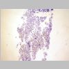 Medula osea SF 01.jpg